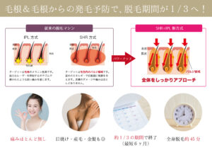 SHR脱毛機器