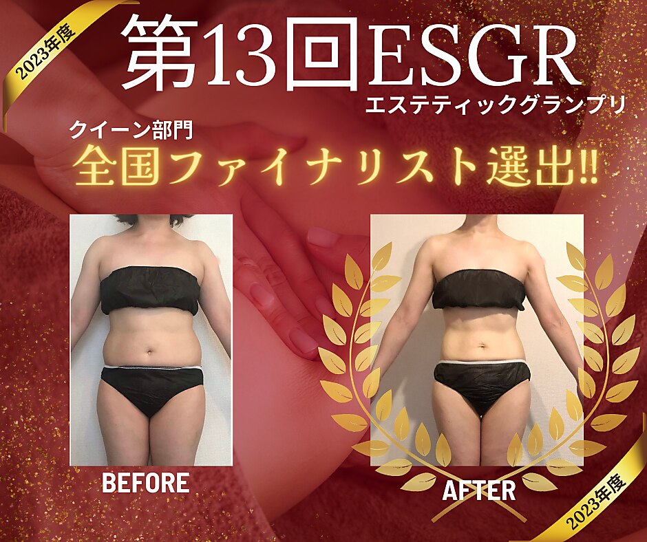 全国エステグランプリ上位