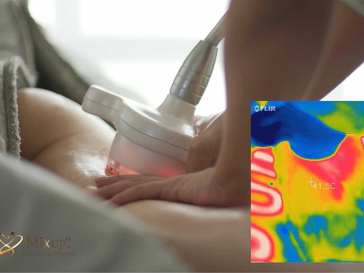 MIXUP 施術（痩身・フェイシャル）